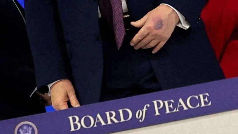 فوٹو سوشل میڈیا