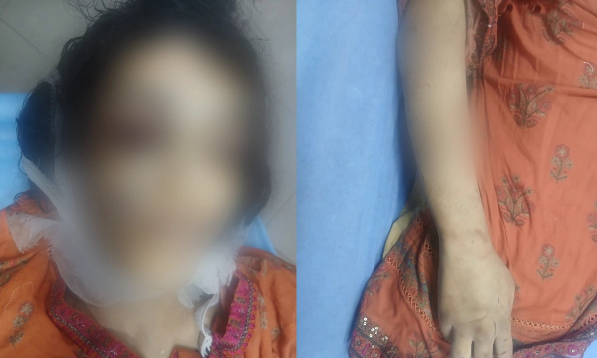 لاہور میں 18 سالہ لڑکی کو باپ اور بہن بھائیوں نے قتل کردیاحساس اعضا جلانے کا انکشاف