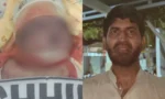 دورانِ ڈلیوری نومولود کے گلے پر کٹ لگ گیا،زخم کے باعث بچہ جاں بحق