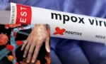 خیبر پختونخوا میں ایم پاکس کے 4 نئے کیسز کی تصدیق